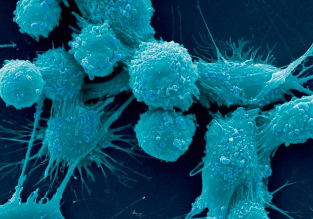 It’s proven, curcumin in turmeric kills colon cancer cells