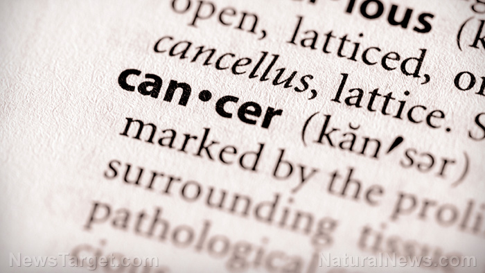 5 mistakes most people make when they get diagnosed with CANCER