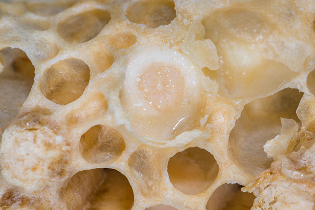 The health benefits of royal jelly can improve outcomes for diabetes patients