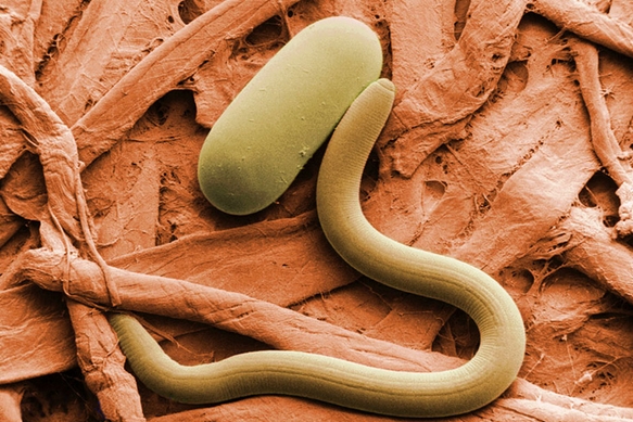Gut microbes can fight parasites: Probiotics may reduce infections, and severity of infections, in developing countries